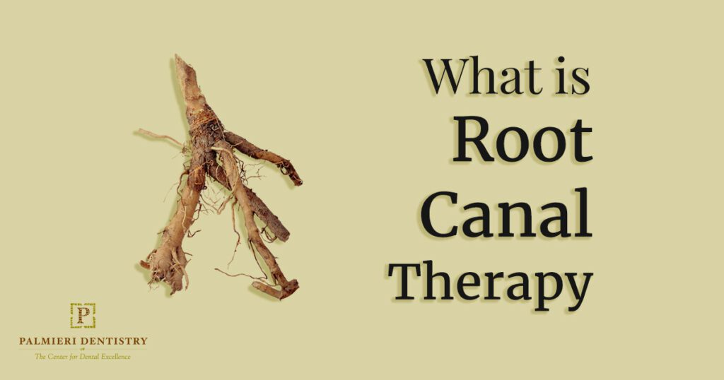 At Palmieri Dentistry, we are passionate about restoring our patients’ oral health and doing all we can to help them keep their natural teeth. When we recommend that a patient schedule an appointment for a dental treatment, we encourage them to do so as soon as possible. Delaying dental care and necessary treatments can cause the problem to worsen. The last treatment we can provide to patients before a tooth extraction becomes necessary is a root canal.
