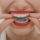 Taking Care of Your Invisalign Trays