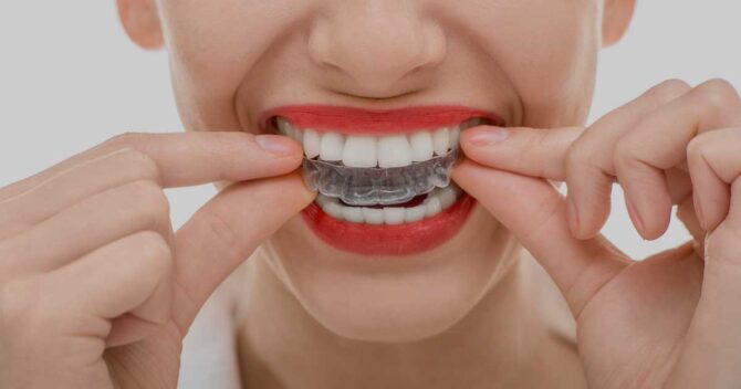 Taking Care of Your Invisalign Trays