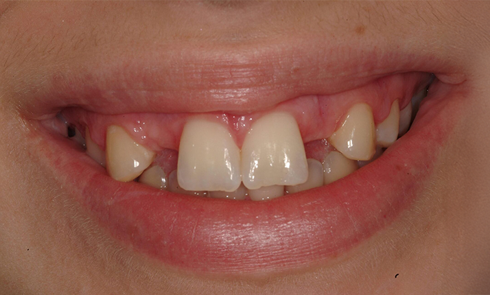 Before