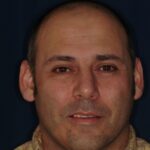 Man with natural smile before dental treatment.