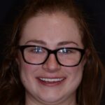 Smiling woman with natural teeth before dental cleaning.