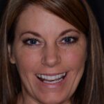 Smiling woman with clean, white teeth after professional dental cleaning.