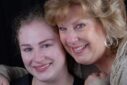 Two women smiling closely together showing healthy teeth.