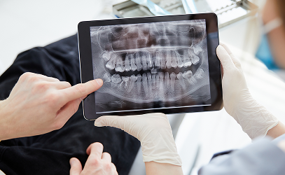 What-Can-Digital-Smile-Design-Show-Before-a-Smile-Makeover-Begins